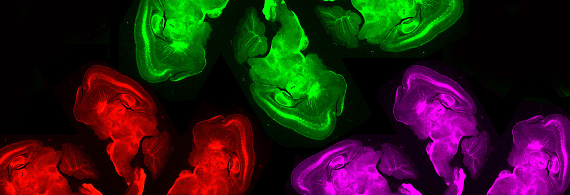 OzdinART™ Sagittal Flowers