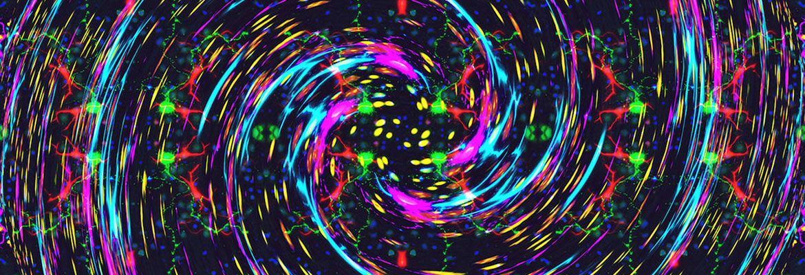 OzdinART™ Motor Neurons in a Twirl