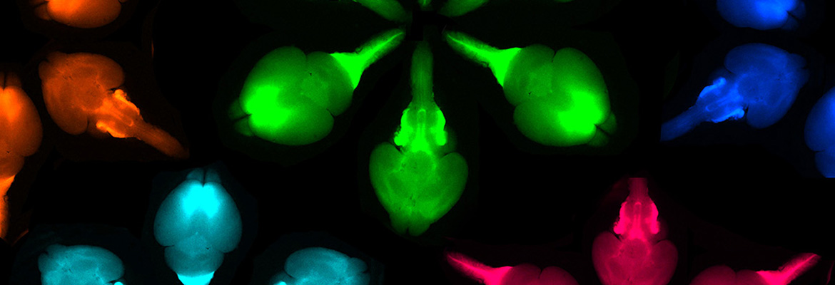 OzdinART™ Fluorescent Brains